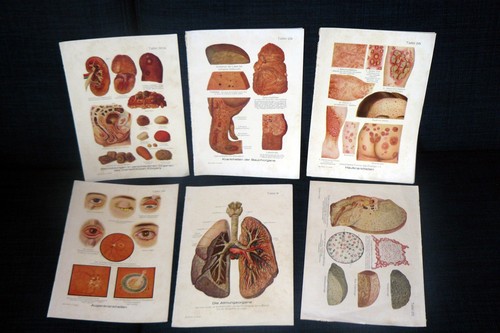 Krankheitsbilder drucke um - krankheitsbilder.,