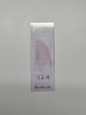 Präparat Malaria Mikroskop Blutausstrich Arzt Hämatologie Labor Mta Objektträger