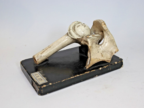 Schultergelenk anatomisches