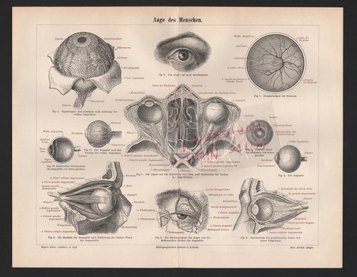 Lithograph 1897 eye man - lithograph, of