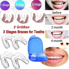 Zahnschiene Knirschen Bequeme