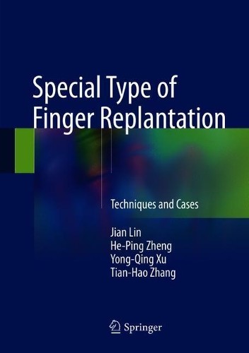 Special type finger - special,