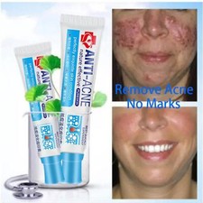 Akne Creme Anti Pickel