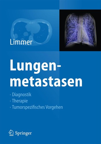 Lungenmetastasen stefan limmer - lungenmetastasen,