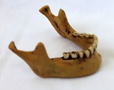 Markus Mayer Unterkiefer für