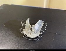 Zahnspange Oberkiefer + Unterkiefer Doppelte Zahnspange