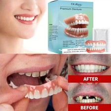 Falsche Zähne Veneers