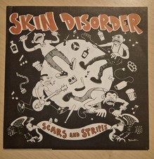 Skin Disorder - Scars and