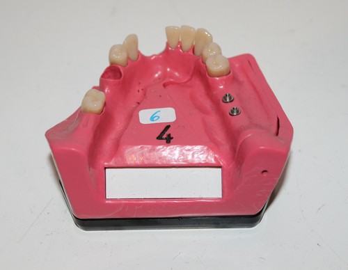 Dent schaumodell 4 - schaumodell,