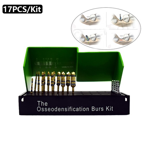 Tlg dental implantat - dental,