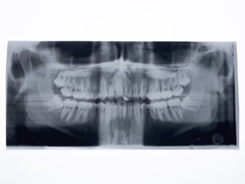 Original panorama dental - original,