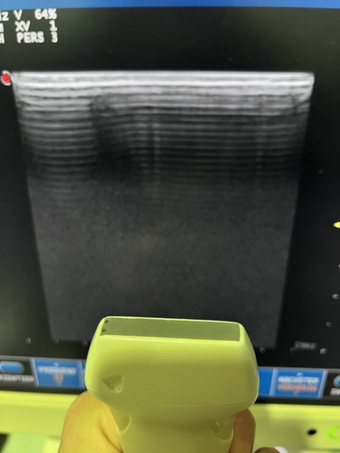 Esaote la435 linear - la435,