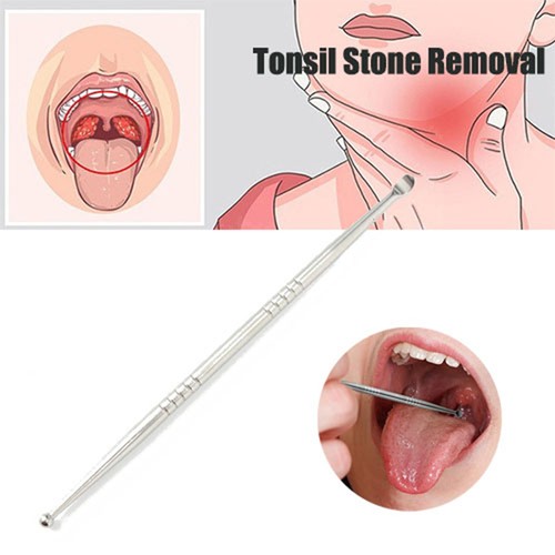 Tonsil stone remove - tonsil, tool