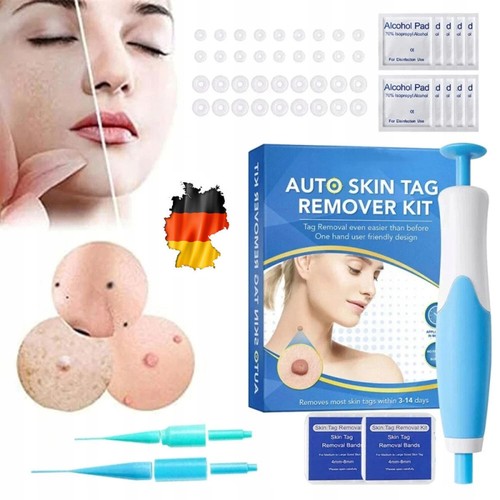Stielwarzen entferner skin tag - stielwarzen,