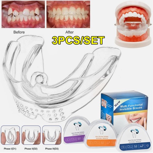 Stage orthodontic teeth - stage,