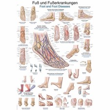 Erler Zimmer anatomische Lehrtafel, Fuß und Fußerkrankungen, 2 Größen