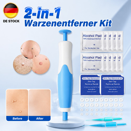 Stielwarzen entferner skin - stielwarzen, entferner,