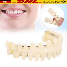 Snap On Veneers Kosmetische