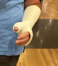 Gipsarm SATS links Kunststoffgips mit langem Schaft weiss Frotteepolster