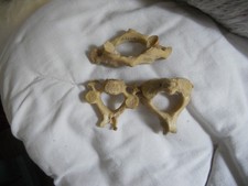 Echte Knochen Wirbelsäule