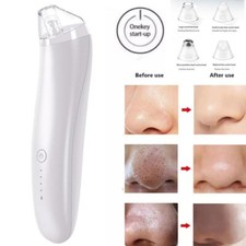 Elektrische Mitesser Entferner