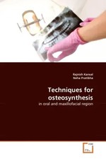 Techniques for osteosynthesis