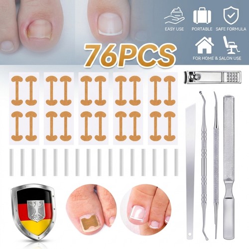 Nagelkorrektur werkzeugset - nagelkorrektur,