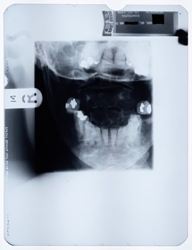 Original dental röntgenfilm - original,