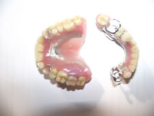 Zahnprothese,zahnersatz,prothese, oberkiefer,unterkiefer, dental,Gebiss,dentures