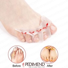 PEDIMEND Gelzehenabscheider, Hammerzehe, Krallenzehenglätter, Ballenkorrektur