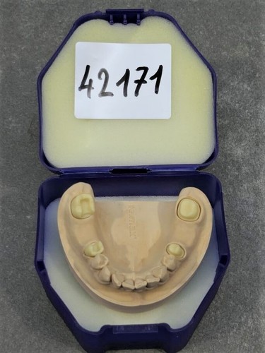 Ivoclar vivadent ips max - ips, e.max