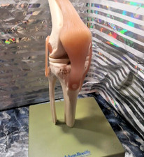 Funktionierendes Somso Knie anatomisches Modellgelenk inkl. Bänder Adam Rouilly NS 50