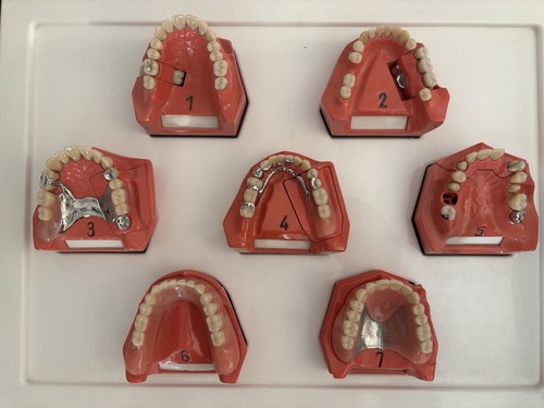 Dent schaumodelle dental - dent,