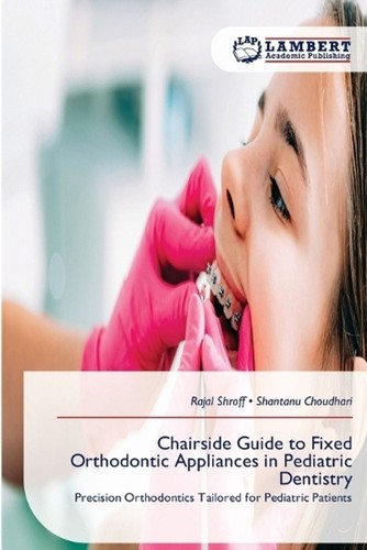 Chairside guide fixed - chairside, to