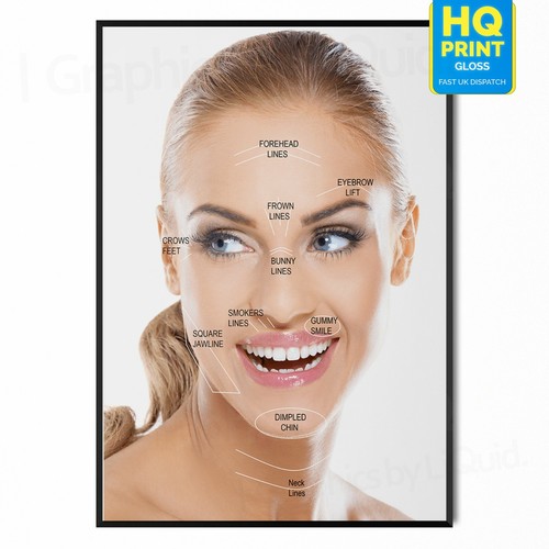 Botox behandlungsbereiche - botox,