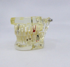 Zahnmodell Schaumodell