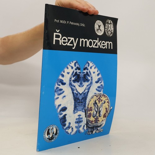řezy mozkem neuroanatomie - mozkem,