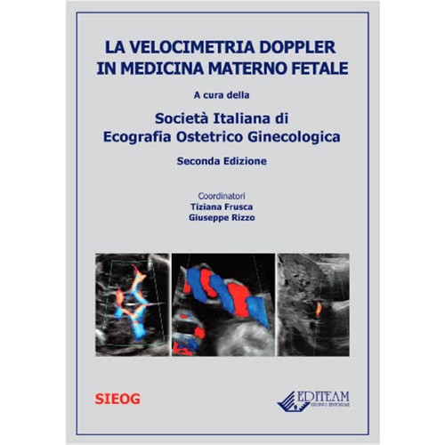 Doppler-Geschwindigkeitsmessun