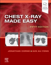 Chest XRay Made Easy by