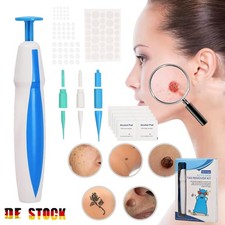 Warzenentferner Set Skin Tag