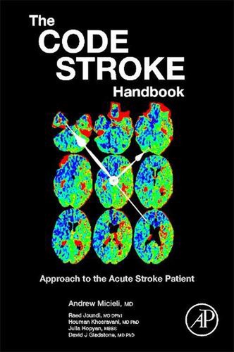 The code stroke - the,