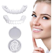 Zahnprothese, Veneers