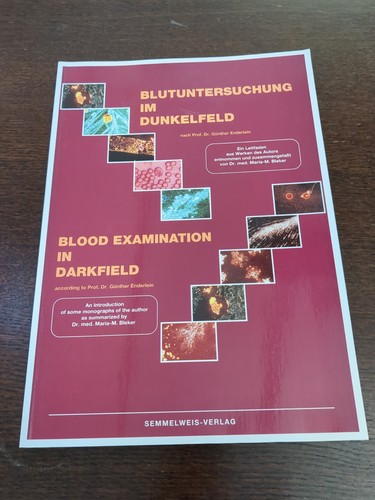 Blutuntersuchung dunkelfeld - blutuntersuchung, im