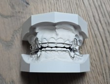 KFO Elastisch Offener