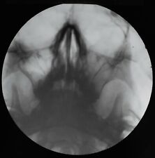 VINTAGE Magic Lantern Slide