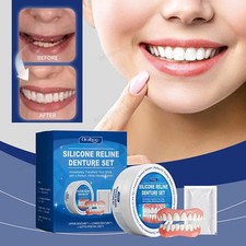 Snap On Veneers Kosmetische