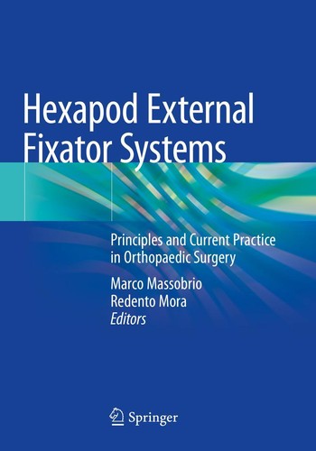 Hexapod external fixator - external,