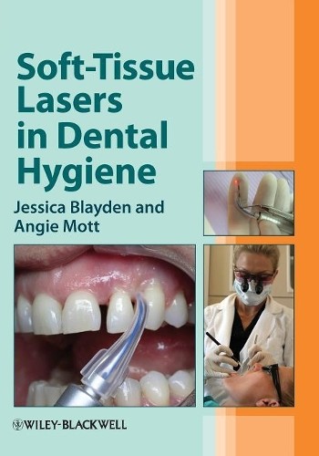 Soft tissue lasers - lasers, in