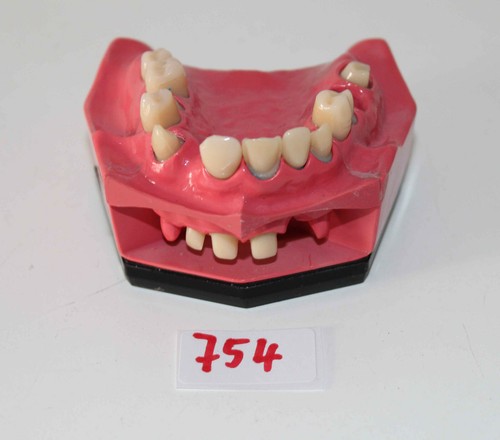 Dent schaumodell 5 - go,