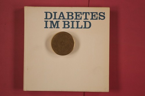 295298 schadewaldt diabetes - schadewaldt,